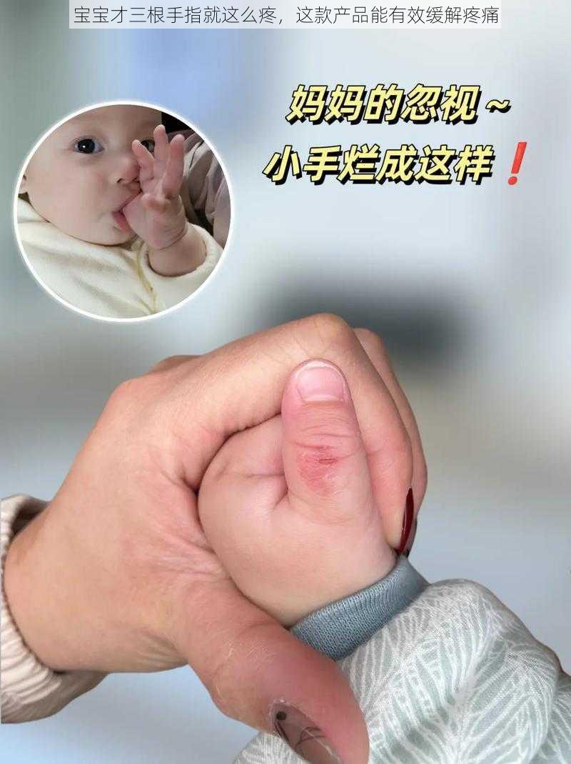 宝宝才三根手指就这么疼,这款产品能有效缓解疼痛