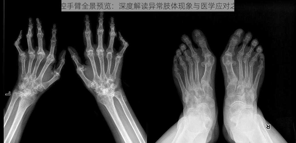 失控手臂全景预览:深度解读异常肢体现象与医学应对之道