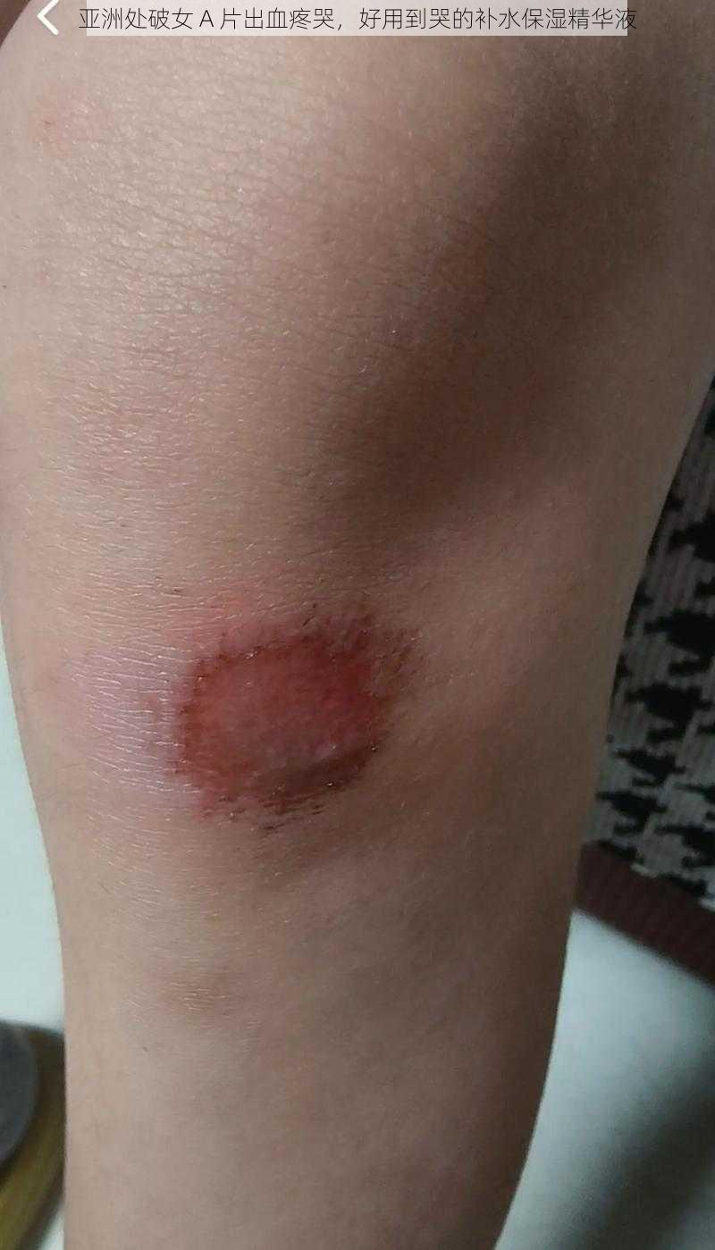 亚洲处破女 A 片出血疼哭,好用到哭的补水保湿精华液