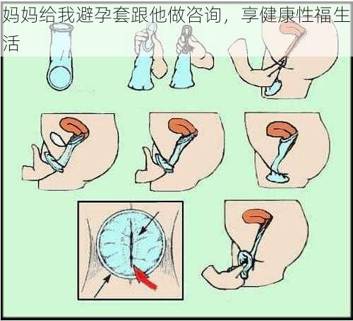 妈妈给我避孕套跟他做咨询,享健康性福生活