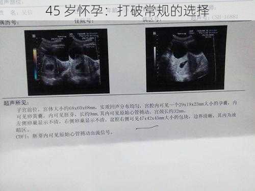 45 岁怀孕:打破常规的选择