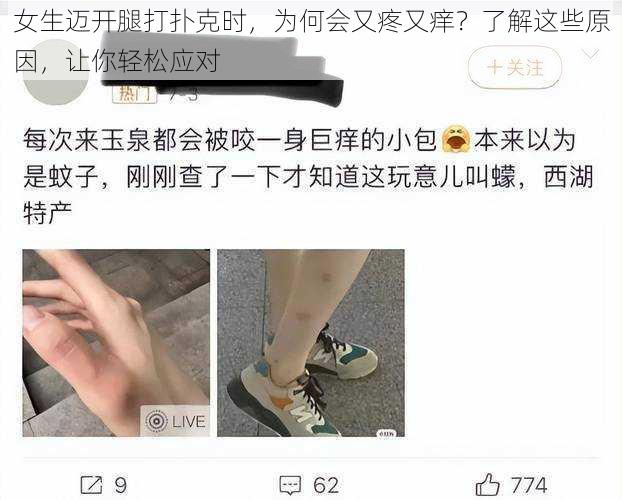女生迈开腿打扑克时,为何会又疼又痒?了解这些原因,让你轻松应对