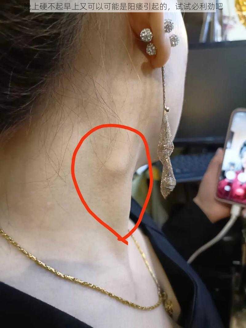晚上硬不起早上又可以可能是阳痿引起的,试试必利劲吧