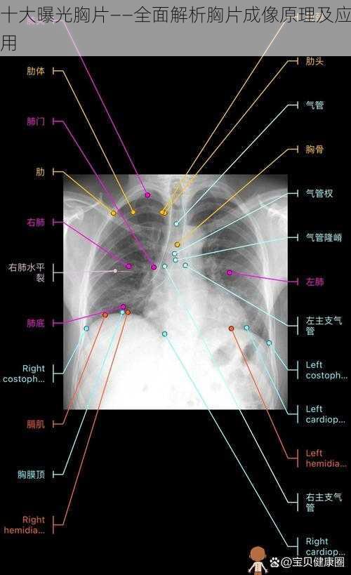 十大曝光胸片——全面解析胸片成像原理及应用