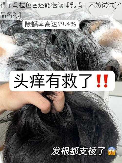 得了马拉色菌还能继续哺乳吗？不妨试试[产品名称]