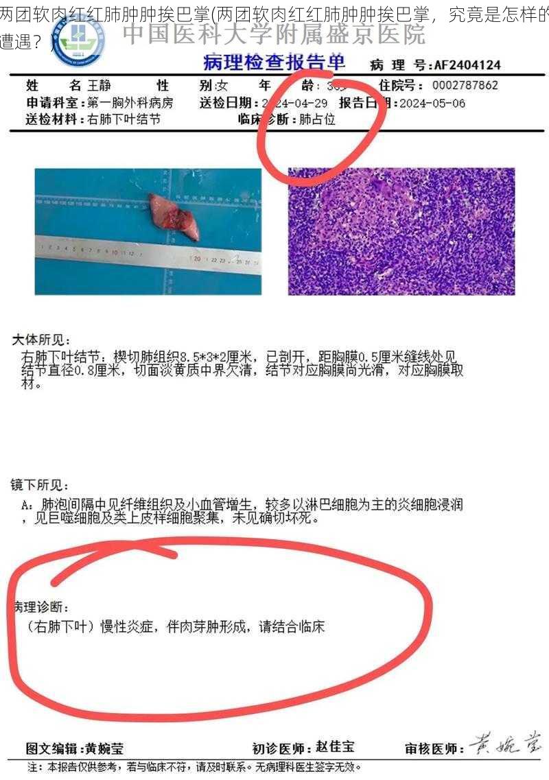 两团软肉红红肺肿肿挨巴掌(两团软肉红红肺肿肿挨巴掌,究竟是怎样的遭遇?)
