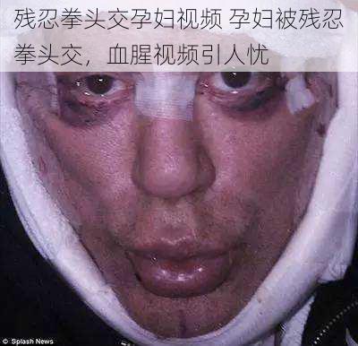 残忍拳头交孕妇视频 孕妇被残忍拳头交，血腥视频引人忧