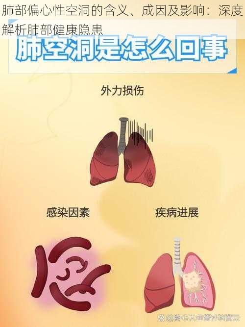 肺部偏心性空洞的含义、成因及影响：深度解析肺部健康隐患